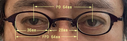強度近視ウスカル瞳孔間距離